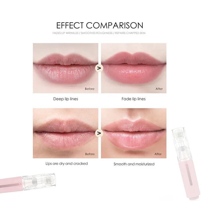 Micro-Needling Lip Filler Roller